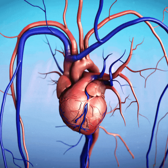 massive heart attack