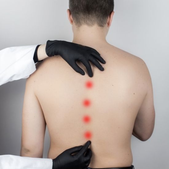 spinal deformity treatment successfully