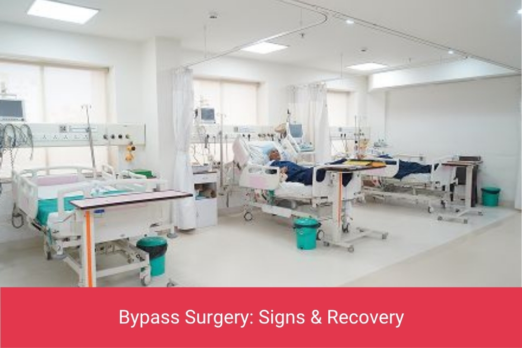Bypass Surgery Signs & Recovery