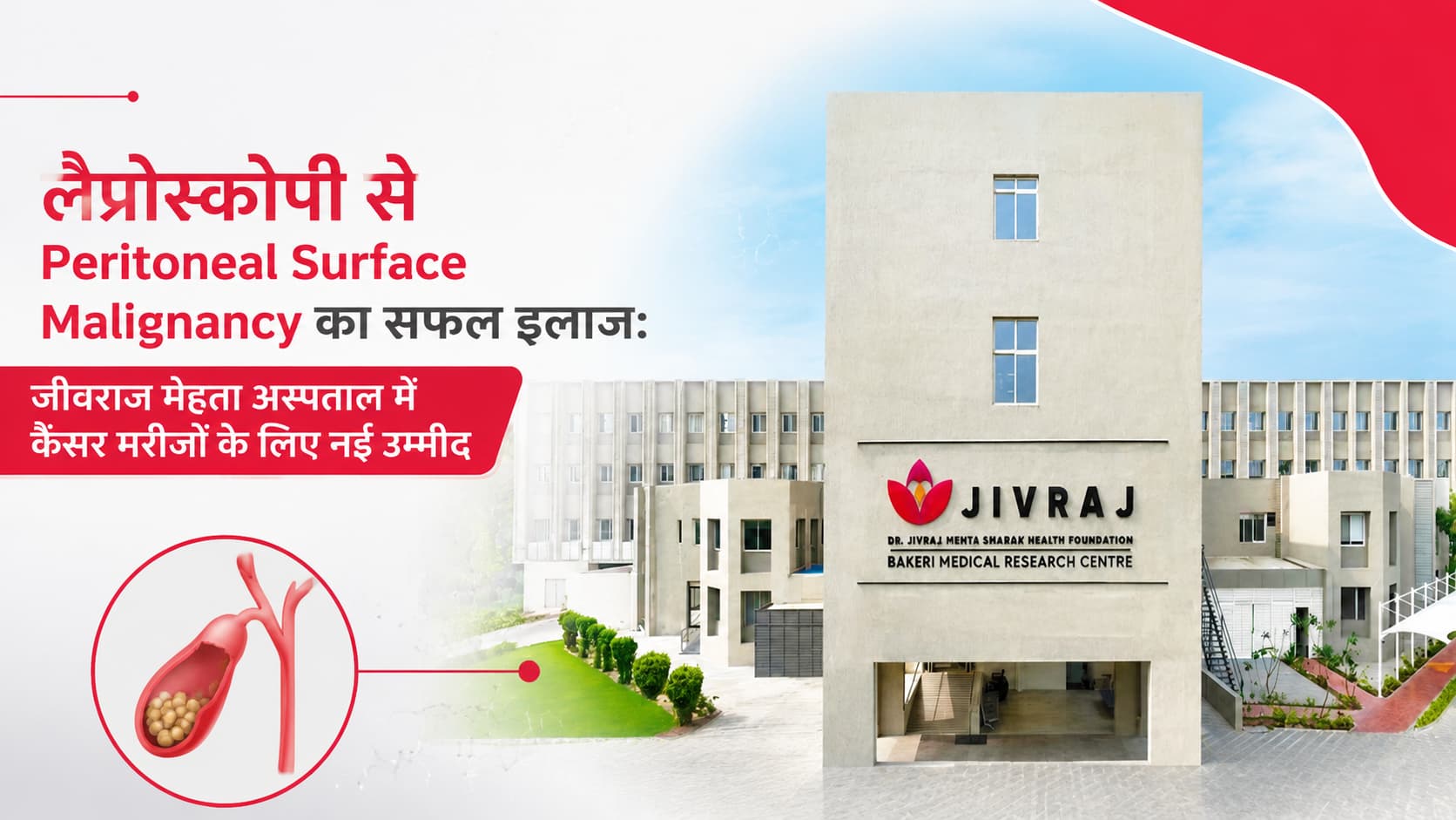 लैप्रोस्कोपी से Peritoneal Surface Malignancy का सफल इलाज: जीवराज मेहता अस्पताल में कैंसर मरीजों के लिए नई उम्मीद