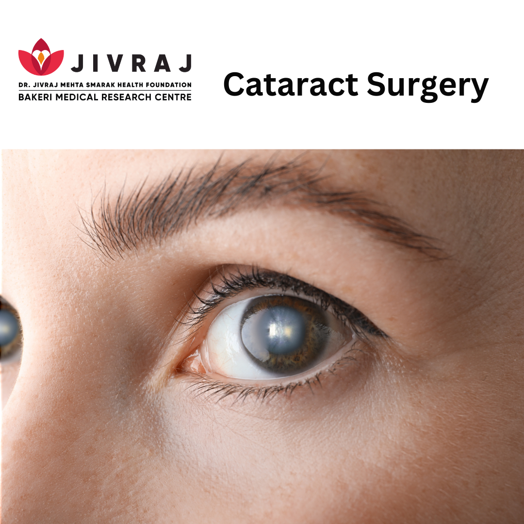 cataract surgery in Ahmedabad