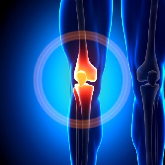 Joint Replacement Surgery