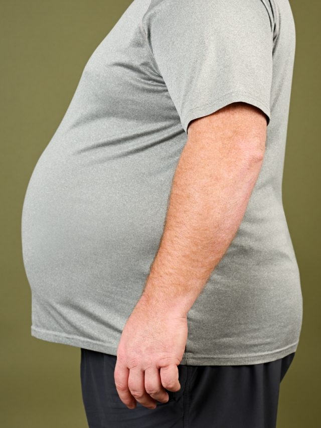 Obesity
