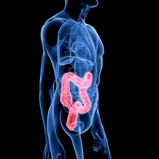 O’Coloplasty (Colon Pull-Up)