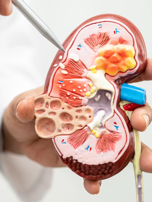 How Diet Impacts Your Bladder & Kidney Health